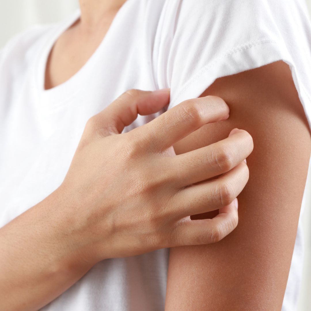 Traitement de l'eczéma