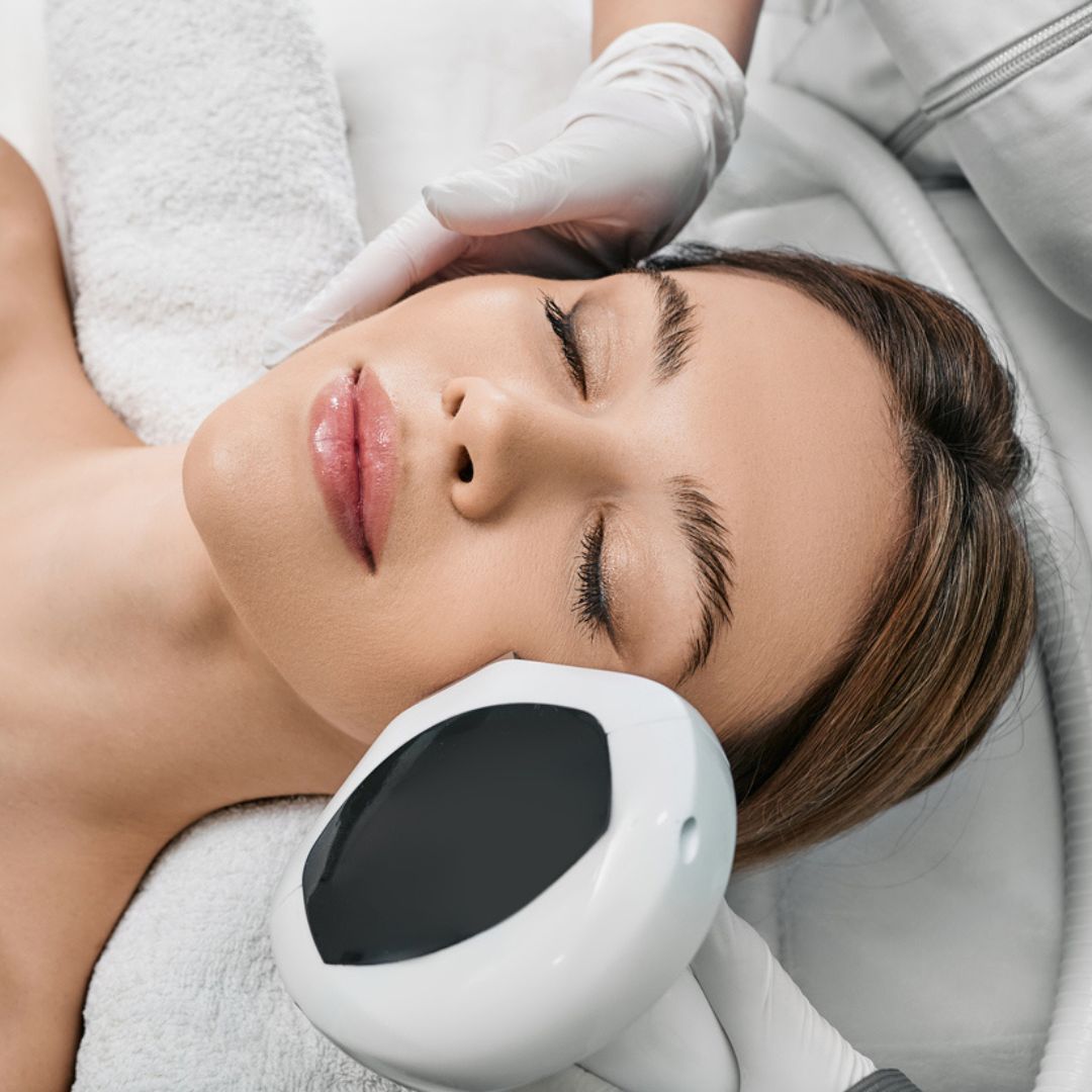 Intense Pulsed Light (IPL)