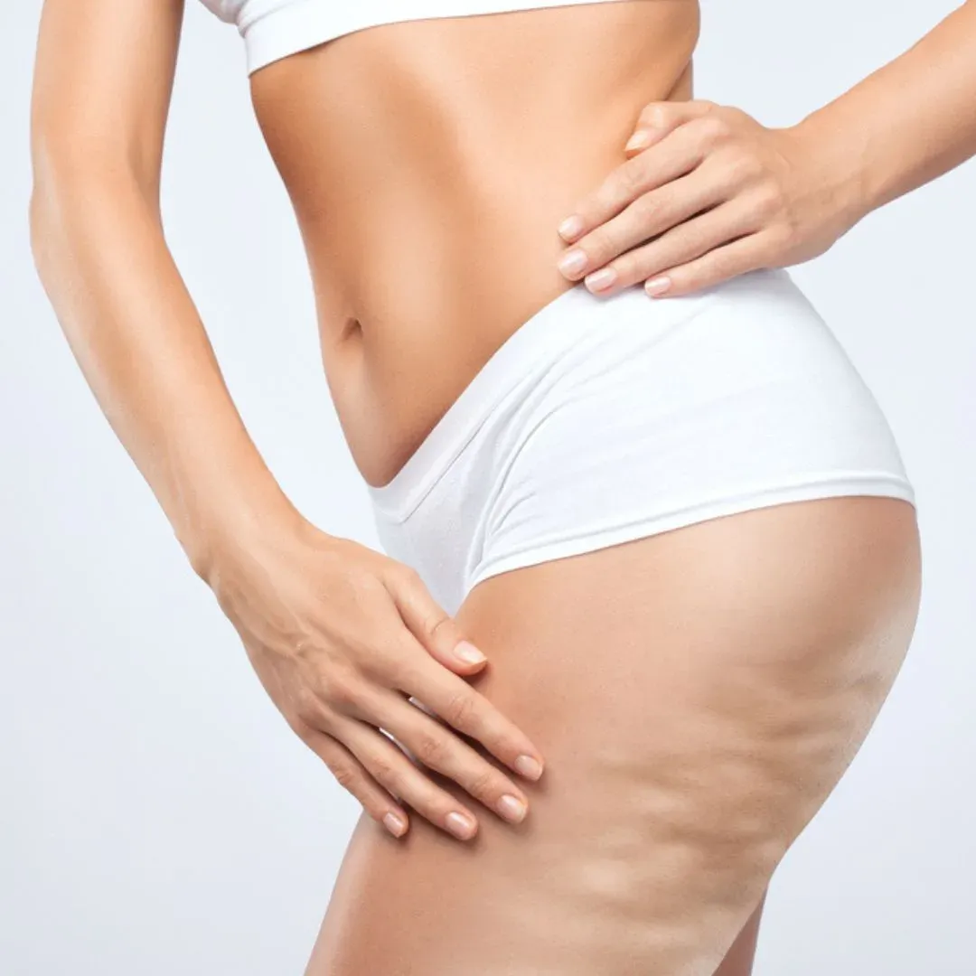 Réduction de la cellulite