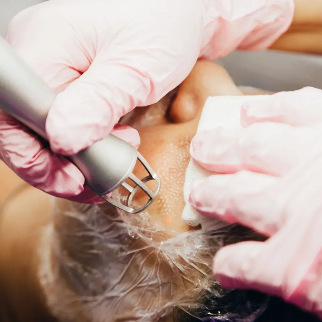 Raffermissement fractionné