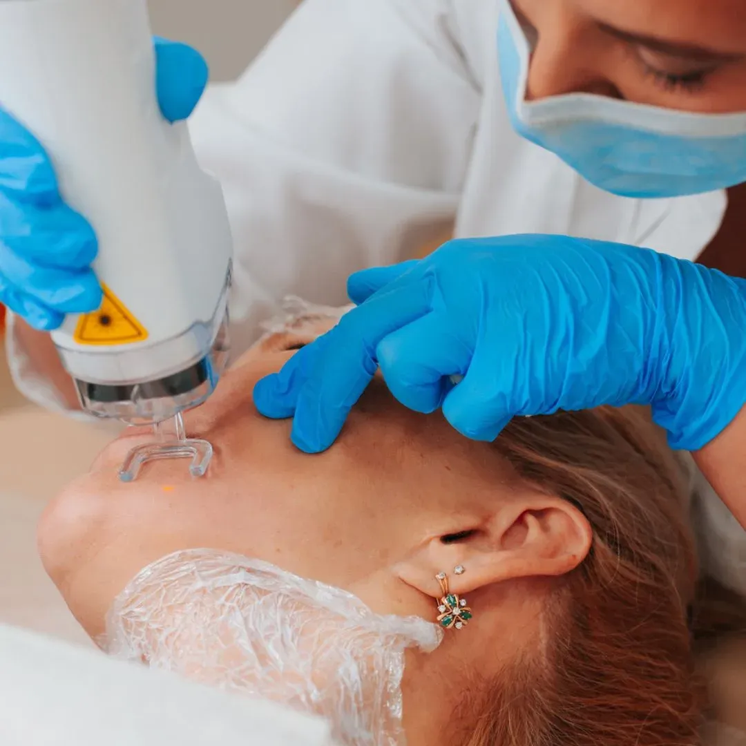 Fractional Laser Resurfacing