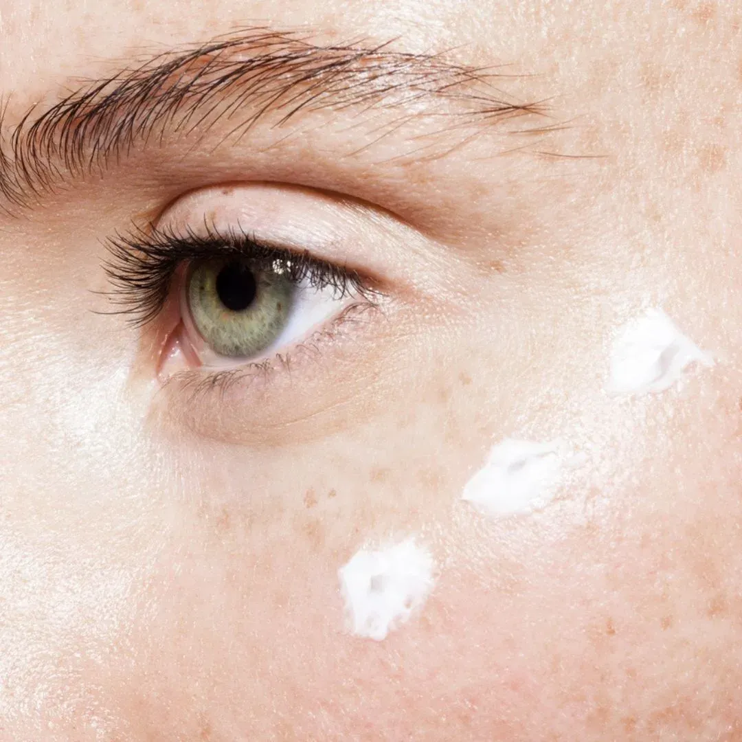 Traitement des cernes sous les yeux