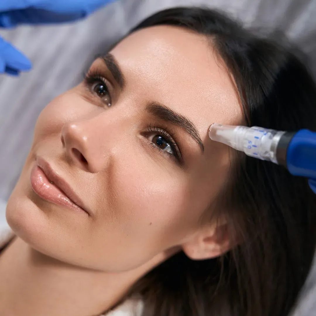 Microneedling