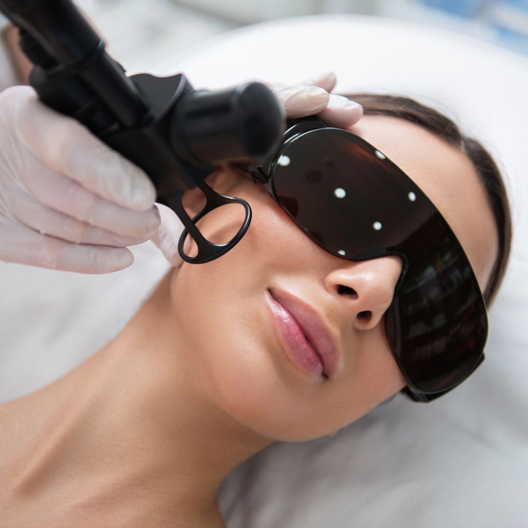 Laser fractionné au CO2