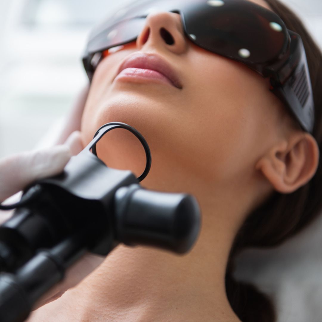 Laser Skin Resurfacing