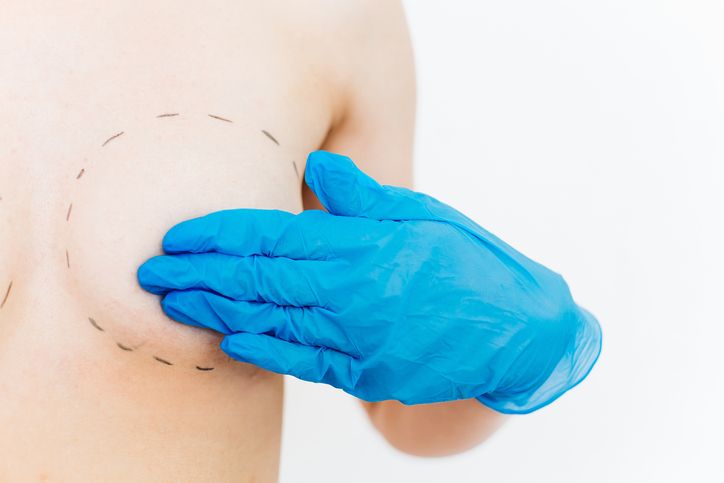 Breast Implant Removal