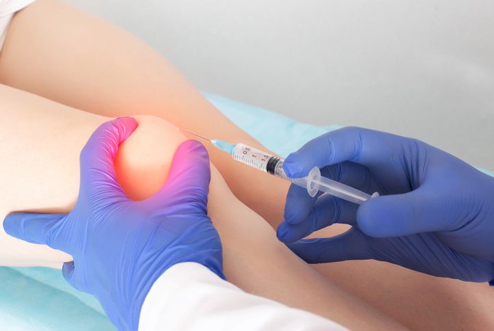 Arthrosamid Joint Injections