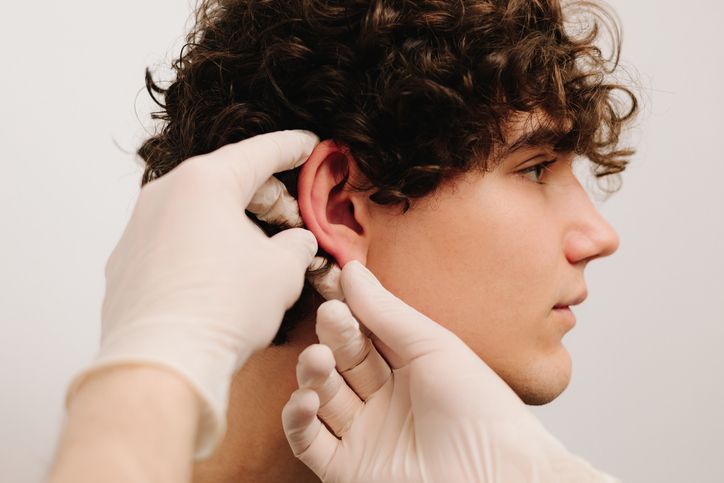 Réparation d'un lobe d'oreille déchiré