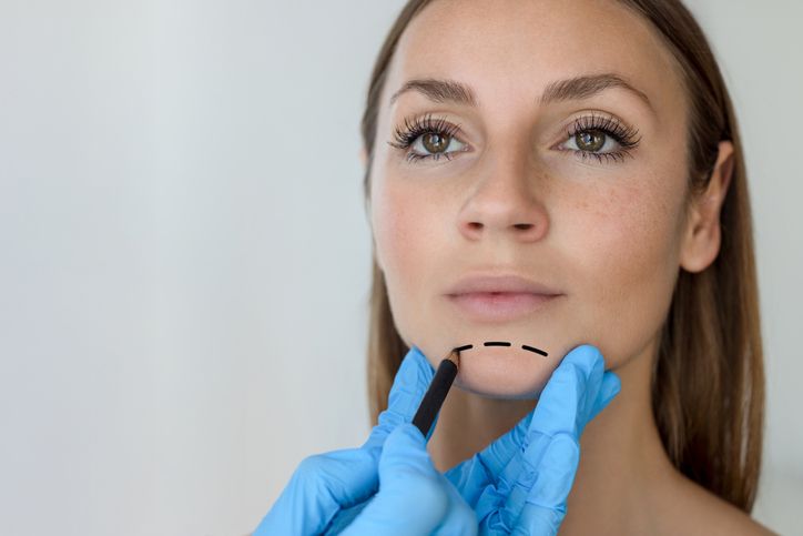 Lifting du bas du visage