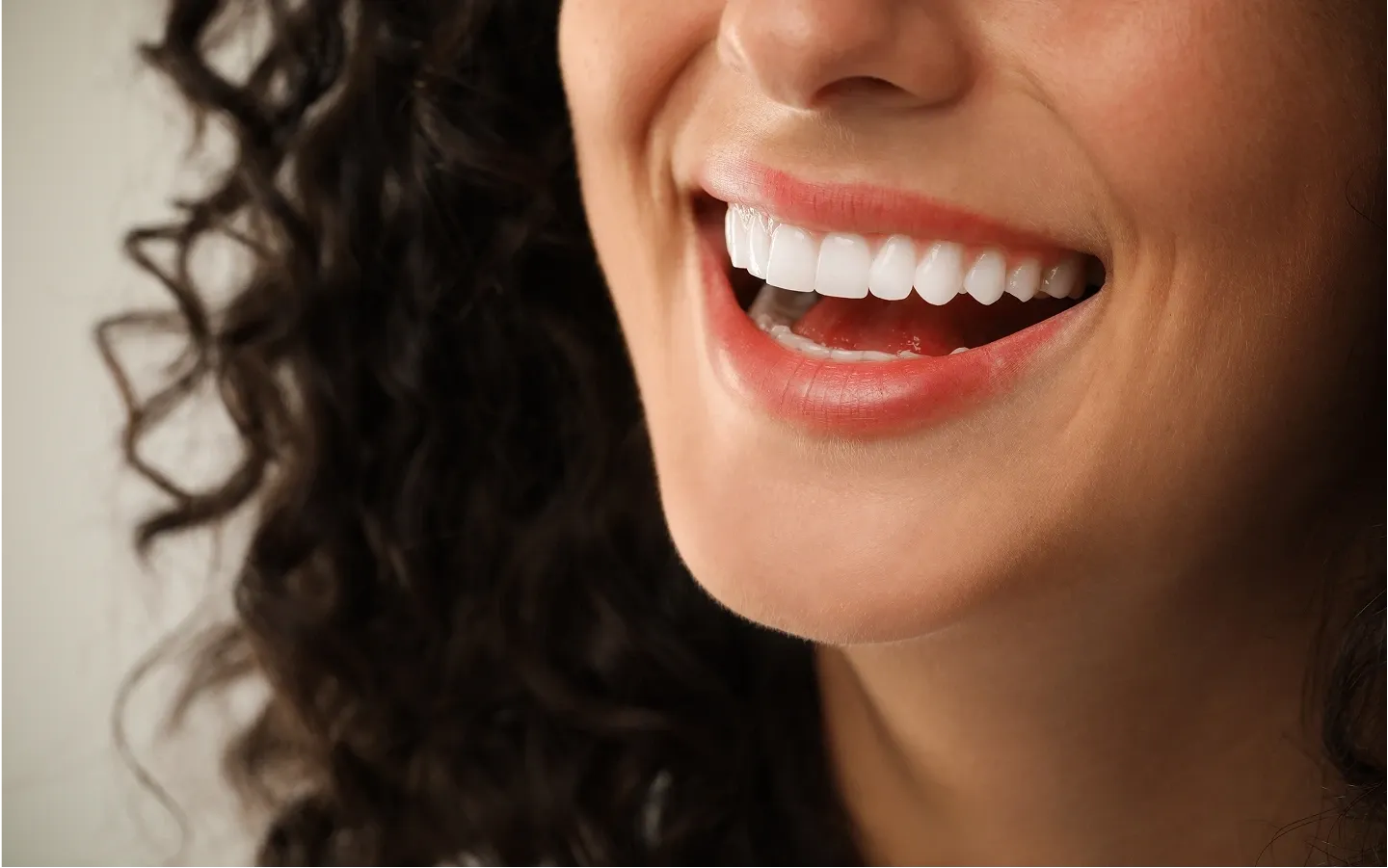 Dental Veneers