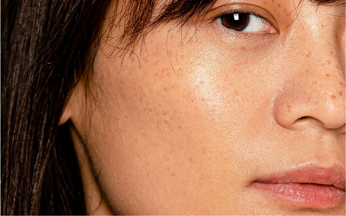 Microneedling